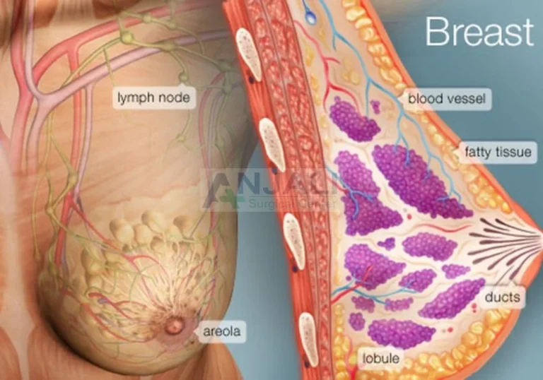 breast-disease.jpg